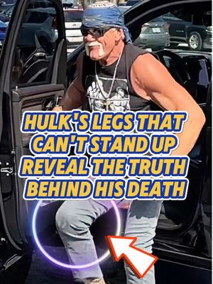 Hulk Hogan Health Issues Behind His Death